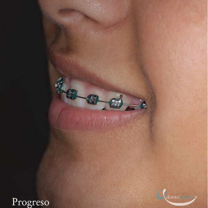 Ortodoncia 002