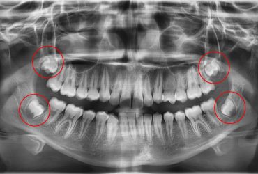 Cirugía Maxilofacial